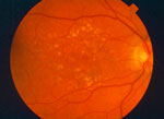 Retina Specialists | FAQs | Columbia MD | Frederick MD | Towson MD | Baltimore MD